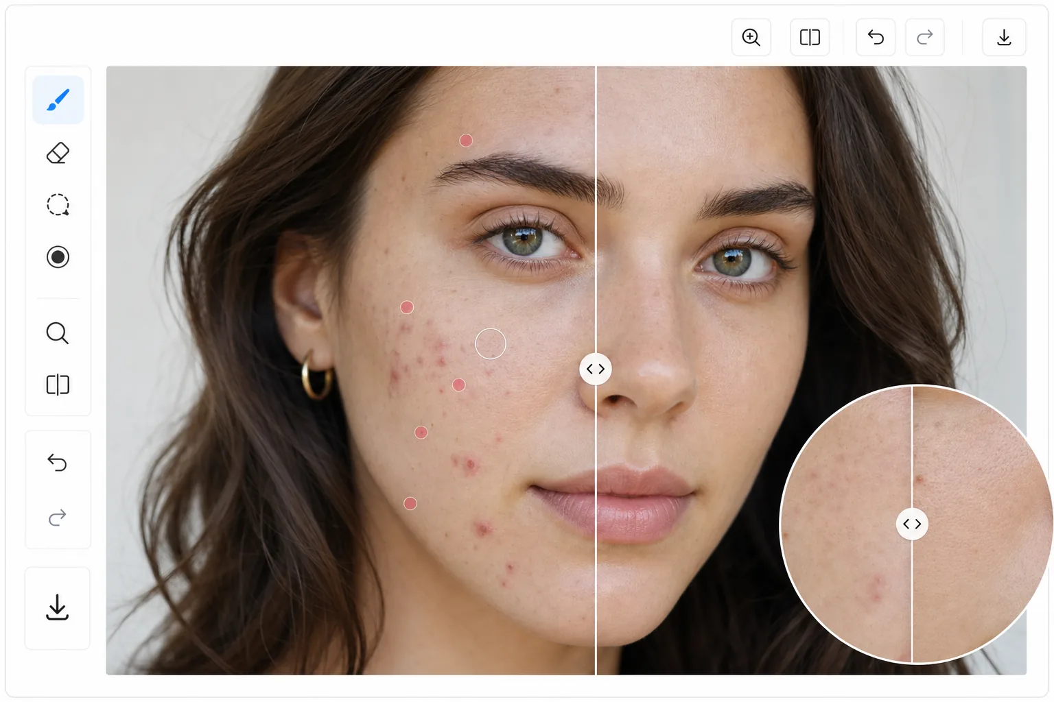 AI acne removal editor showing brushed blemishes on a portrait and a natural retouched result with preserved skin texture