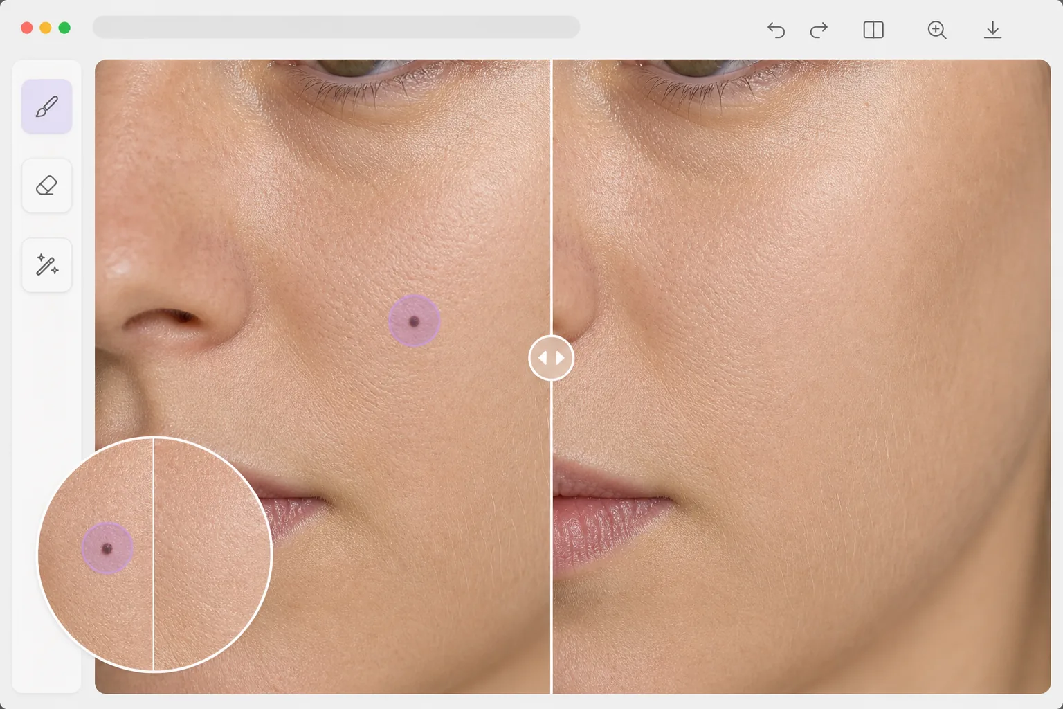 AI mole removal workflow showing a small cheek mole selected with a narrow brush mask and natural skin texture reconstructed after removal