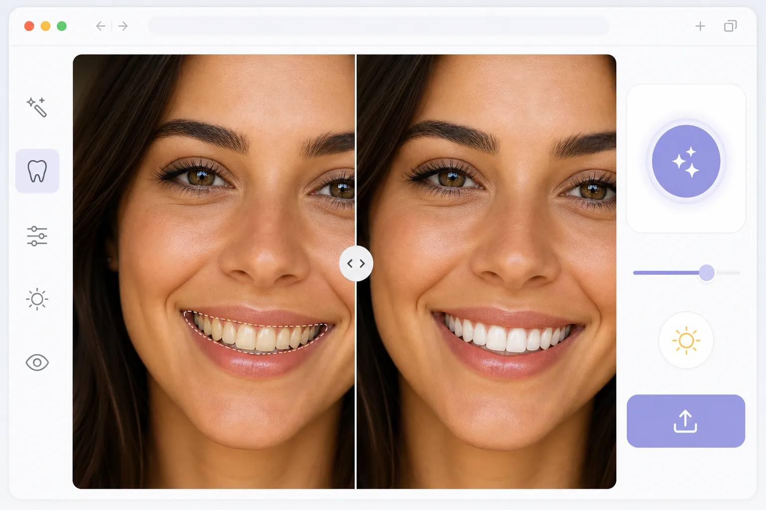 Teeth whitening workflow showing a smiling portrait before and after natural AI enhancement with tooth detection and intensity controls