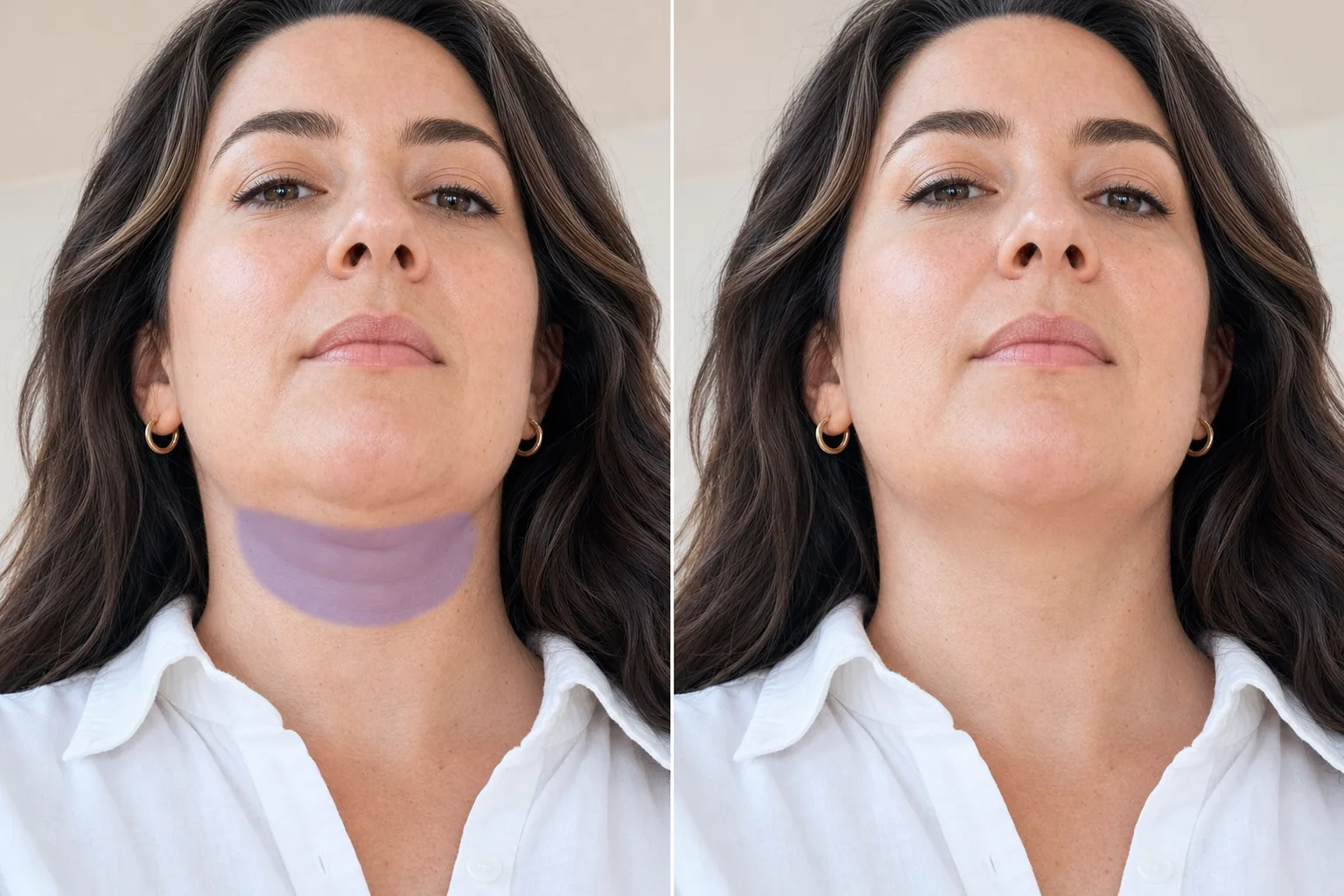 Before and after low-angle portrait showing a masked under-chin fold subtly smoothed